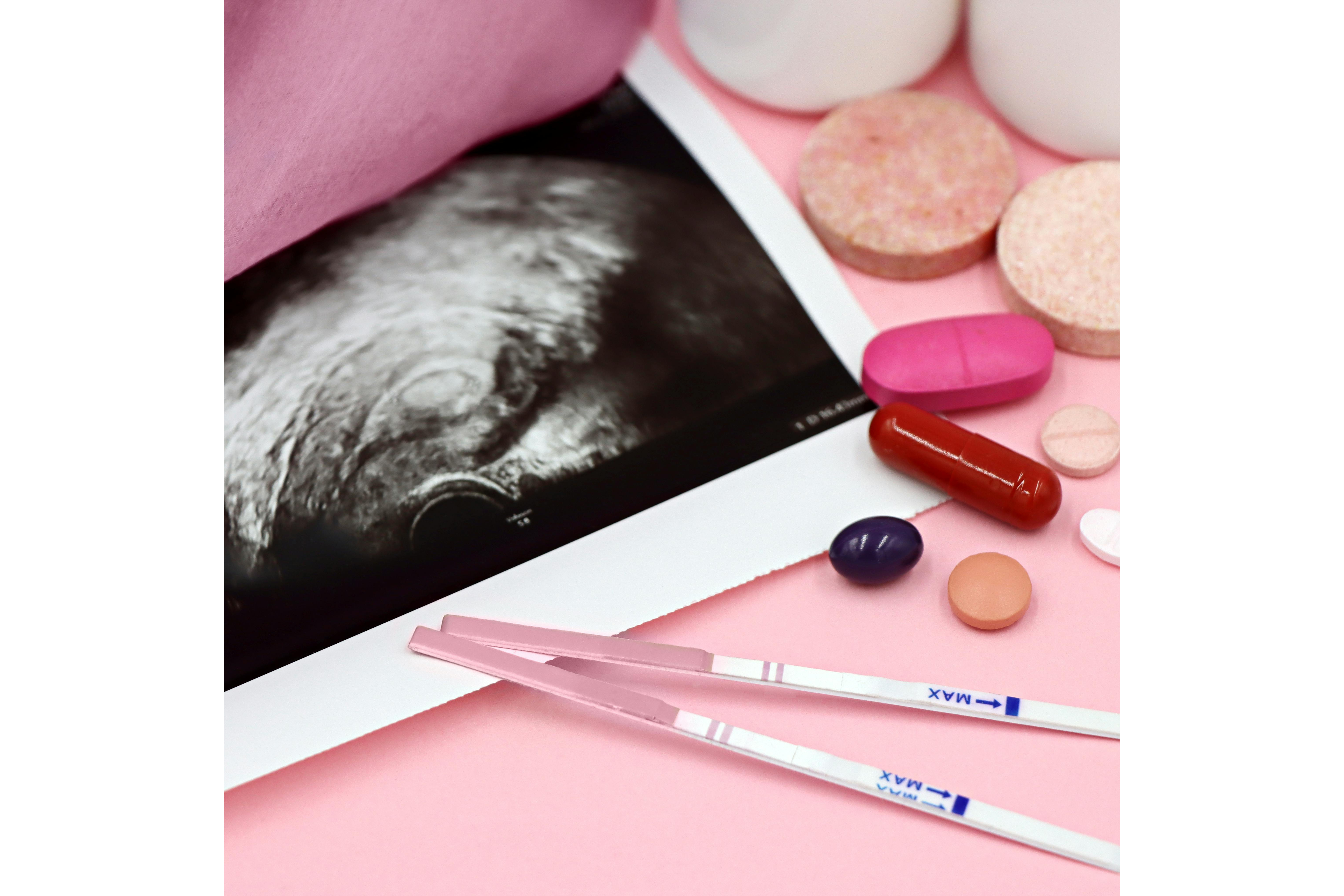 Prenatal Vitamins During Pregnancy: Benefits, Key Nutrients & How to Choose
